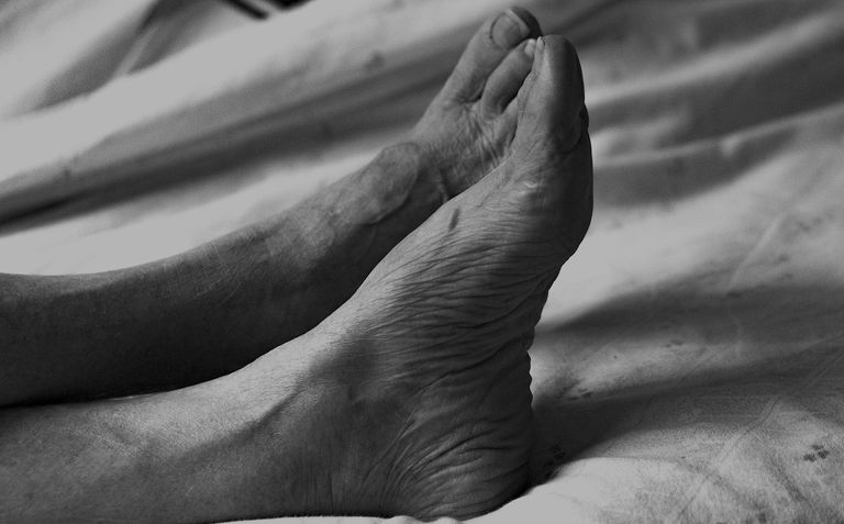 Detailed black and white image of elderly person's feet, showcasing wrinkles and texture.